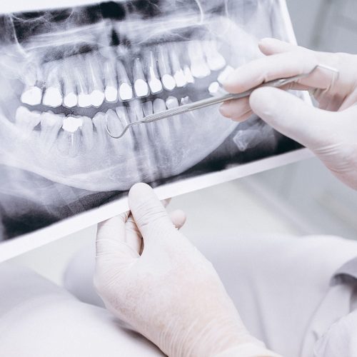 Rentgenodiagnostyka cyfrowa « Stomatologia - Ozimek